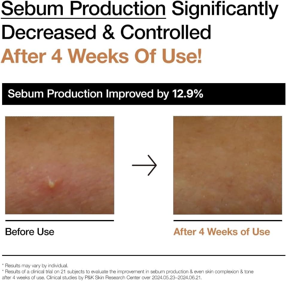 تونر شیری درخشان ANUA Rice 70، برای پوست شیشه‌ای، حاوی Rice Water، نیاسینامید، سرامیدها، پانتنول، غیر کومدون‌زا، مناسب برای آکنه قارچی، مراقبت پوستی کره‌ای، 250ml/8.45fl.oz. 2240