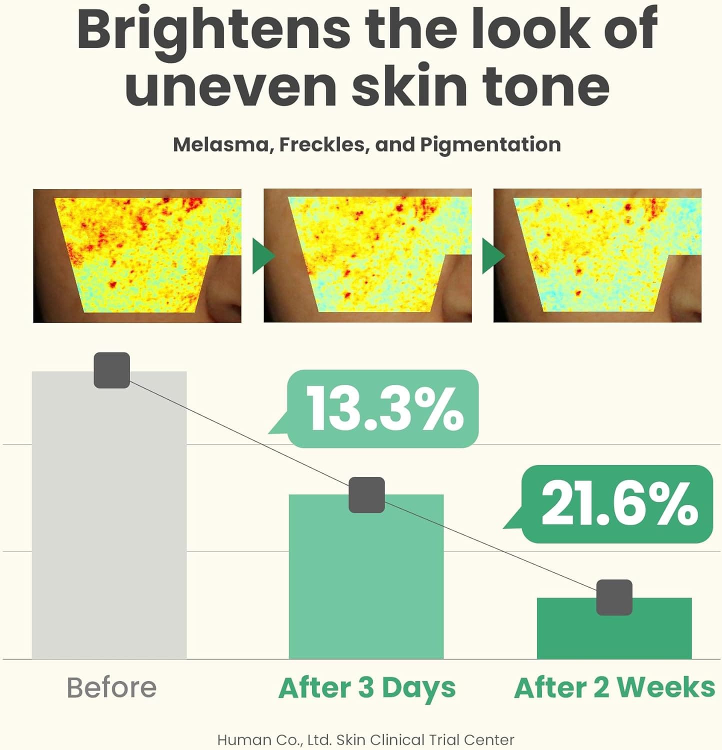 سرم درخشان اصلاح‌کننده لک تیره AXIS-Y حجم 50 میلی‌لیتر - حاوی 5% Niacinamide برای رفع لک‌های تیره صورت - مراقبت پوستی وگان کره‌ای، سرم Niacinamide مناسب برای انواع پوست - 1.69 اونس مایع / 50 میلی‌لیتر (بسته 1 عددی) 3233